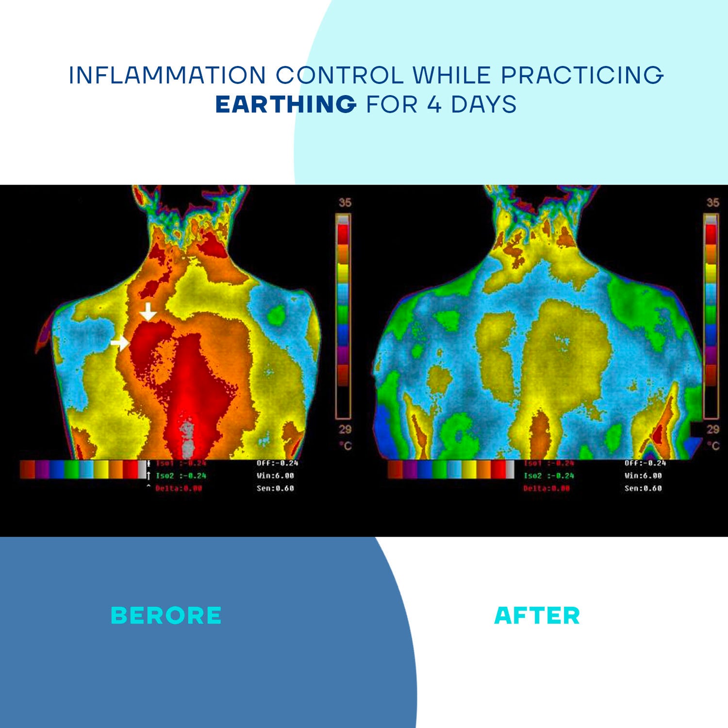 Inflammation control while practicing earthing for 4 days